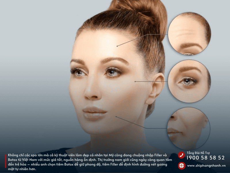 vi sao nhu cau gui filter va botox di my ngay cang cao